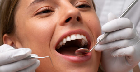 Bruxism & Botox Treatment