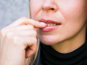 Bruxism and Wrinkles