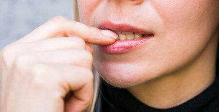 Bruxism and Wrinkles