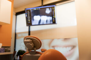 What to Do Immediately If You Chip Crack or Knock Out a Tooth