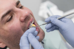 cracked tooth examination