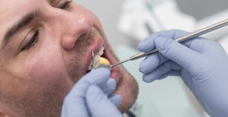 cracked tooth examination