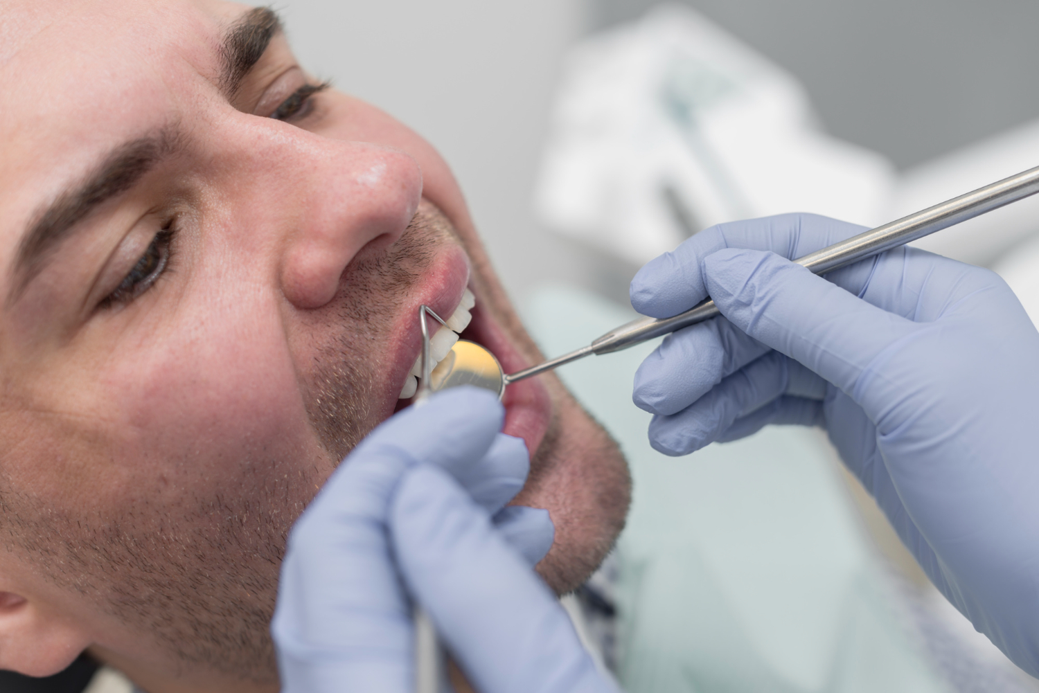 cracked tooth examination
