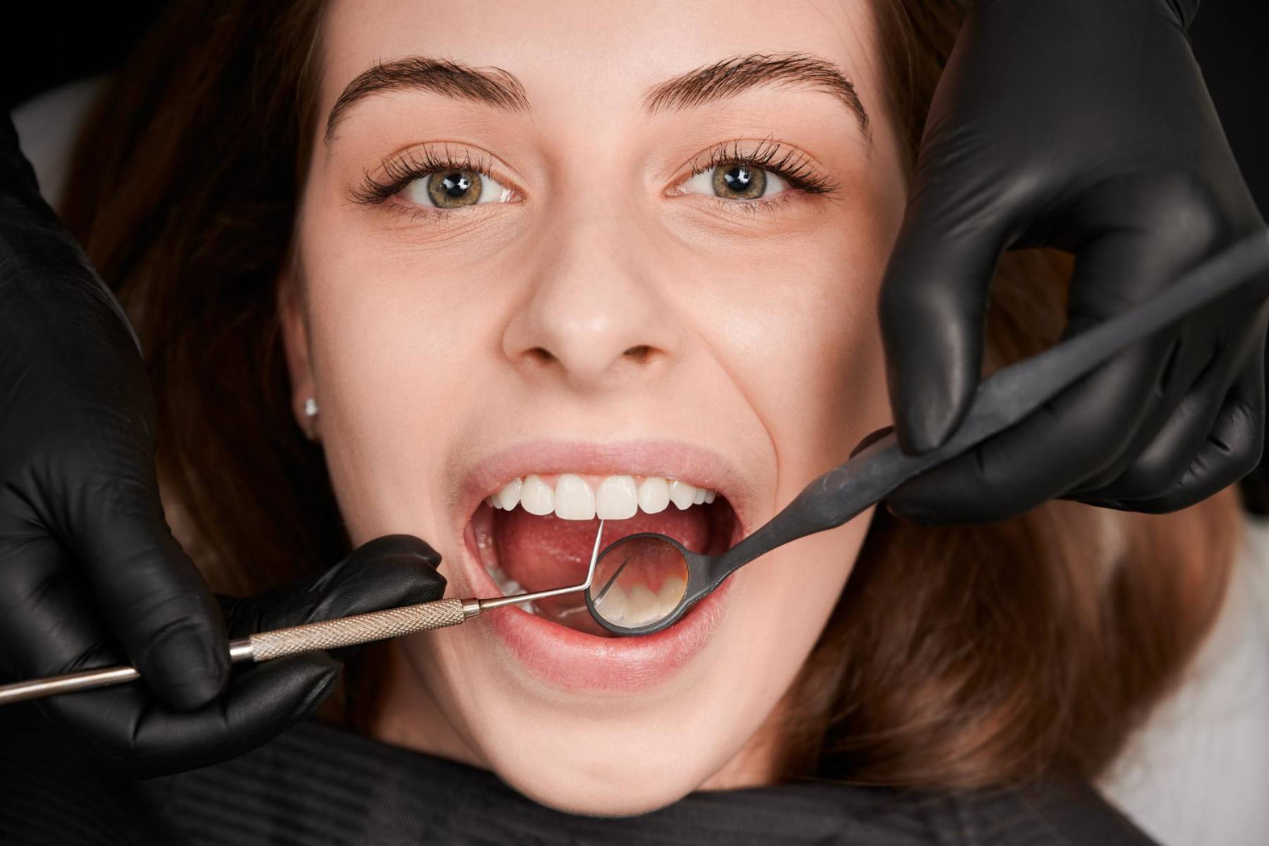 dentist hands sterile gloves examining woman teeth