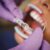 fitting invisalign dentures