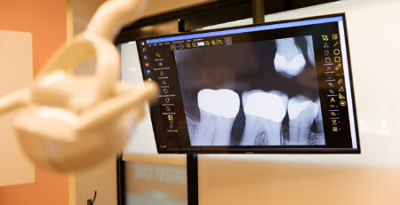 gum disease shown on xray scan