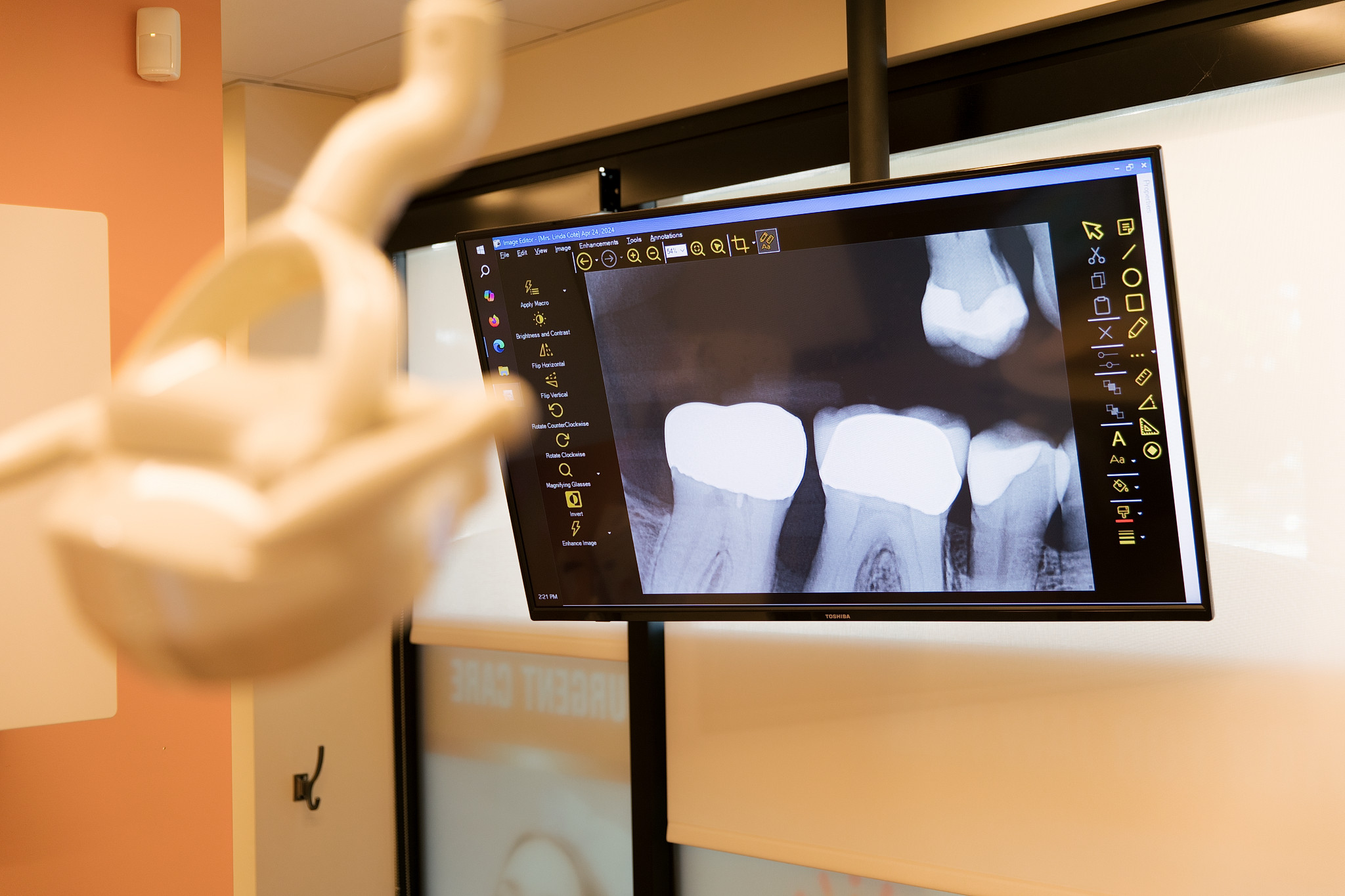 gum disease shown on xray scan