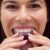invisalign installation