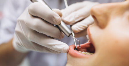 teeth clean at lumina dental