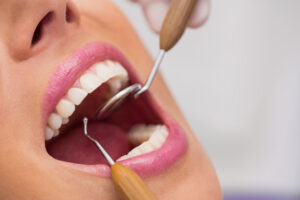 teeth maintenance